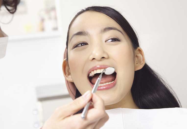 歯石除去の施術を受ける女性